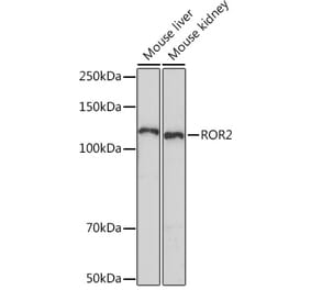 Western Blot - Anti-ROR2 Antibody [ARC1197] (A306995) - Antibodies.com