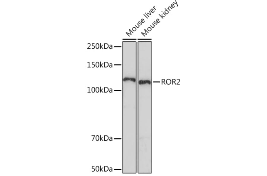 Western Blot - Anti-ROR2 Antibody [ARC1197] (A306995) - Antibodies.com