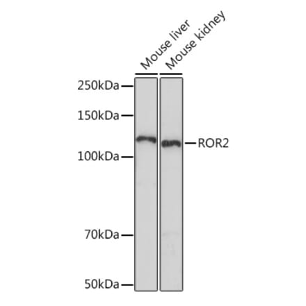 Western Blot - Anti-ROR2 Antibody [ARC1197] (A306995) - Antibodies.com