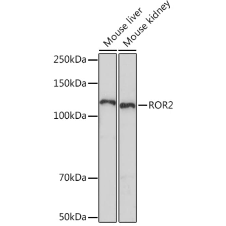 Western Blot - Anti-ROR2 Antibody [ARC1197] (A306995) - Antibodies.com