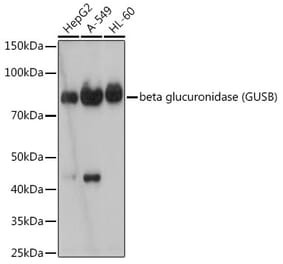Western Blot - Anti-beta glucuronidase (GUSB) Antibody [ARC2408] (A306996) - Antibodies.com