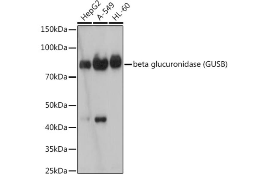 Western Blot - Anti-beta glucuronidase (GUSB) Antibody [ARC2408] (A306996) - Antibodies.com