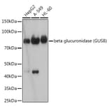 Western Blot - Anti-beta glucuronidase (GUSB) Antibody [ARC2408] (A306996) - Antibodies.com