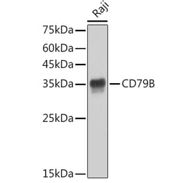 Western Blot - Anti-CD79b Antibody [ARC52688] (A306997) - Antibodies.com