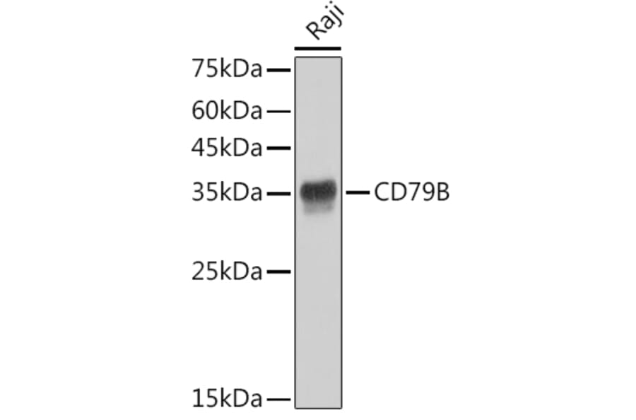 Western Blot - Anti-CD79b Antibody [ARC52688] (A306997) - Antibodies.com