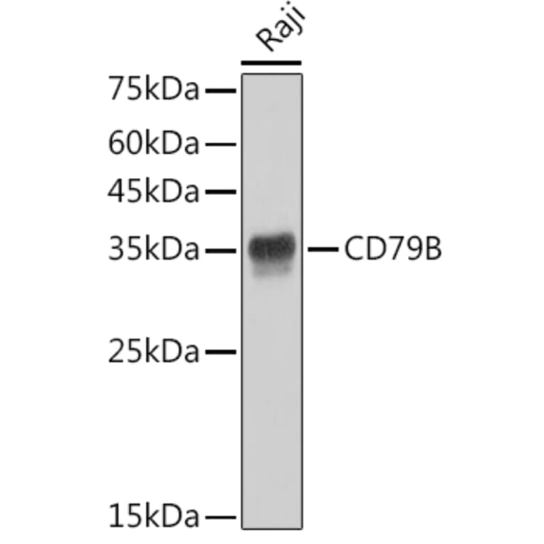 Western Blot - Anti-CD79b Antibody [ARC52688] (A306997) - Antibodies.com