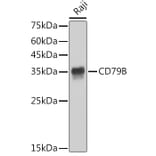Western Blot - Anti-CD79b Antibody [ARC52688] (A306997) - Antibodies.com