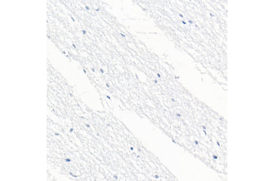 Immunohistochemistry - Anti-CD79b Antibody [ARC52688] (A306997) - Antibodies.com
