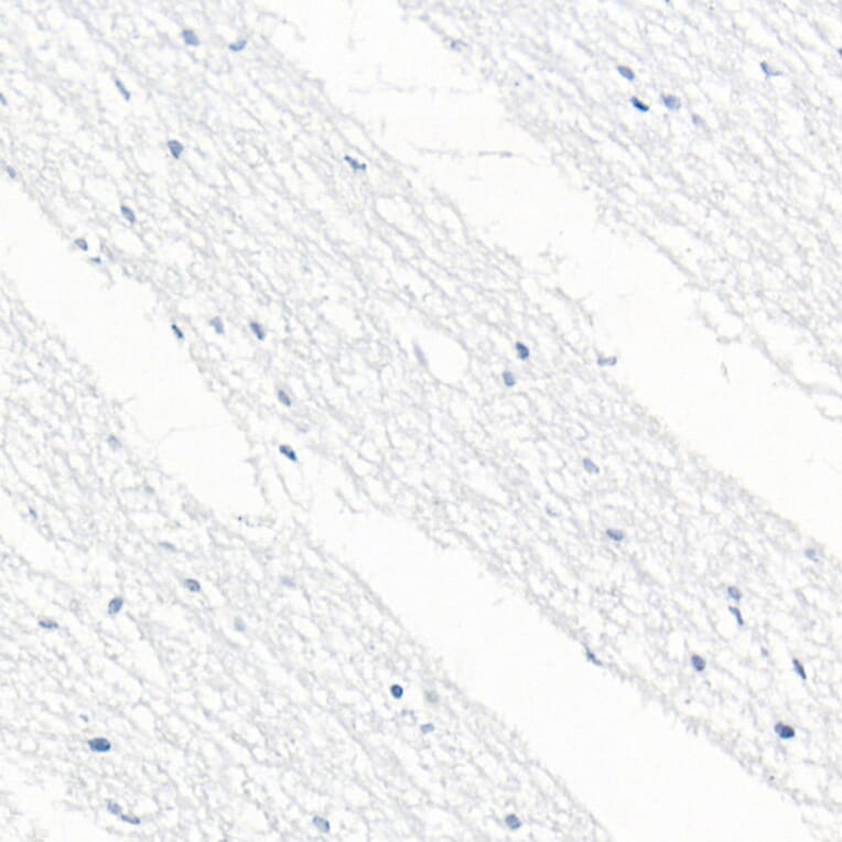 Immunohistochemistry - Anti-CD79b Antibody [ARC52688] (A306997) - Antibodies.com
