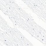 Immunohistochemistry - Anti-CD79b Antibody [ARC52688] (A306997) - Antibodies.com