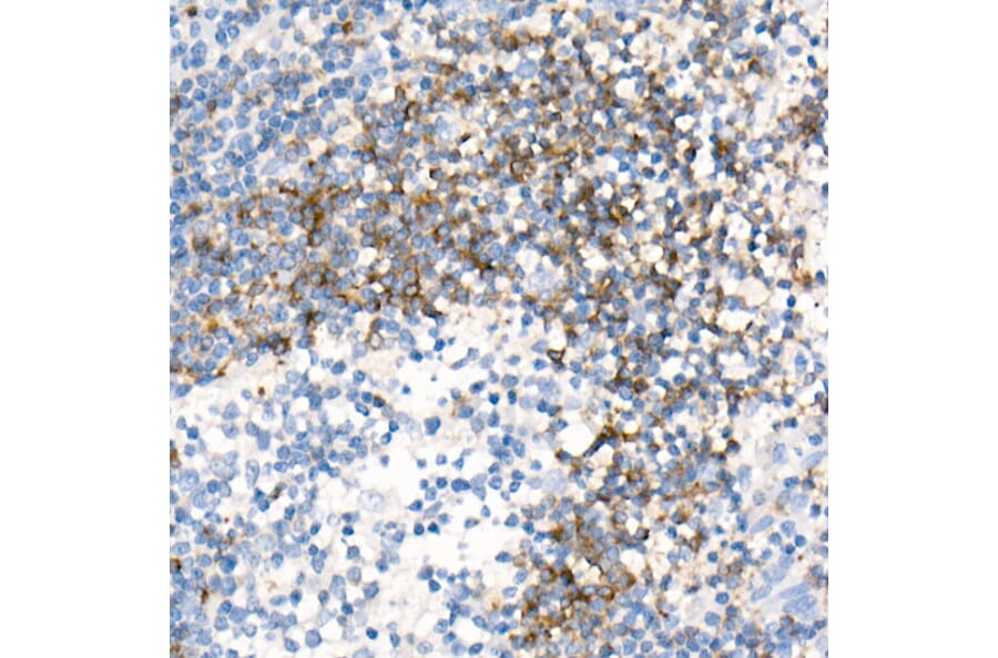 Immunohistochemistry - Anti-CD79b Antibody [ARC52688] (A306997) - Antibodies.com