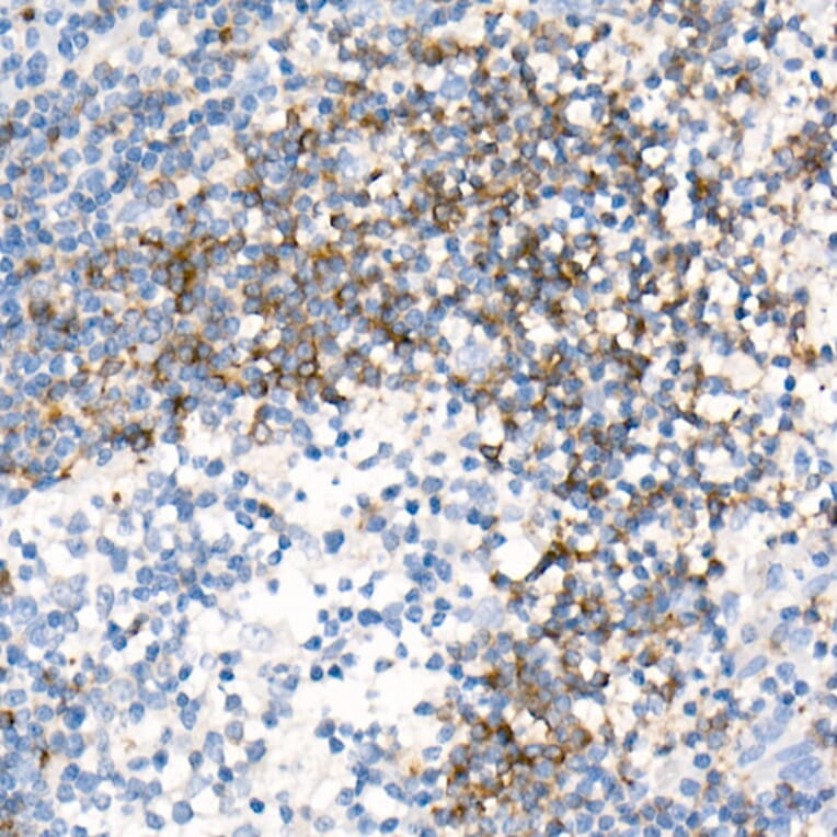 Immunohistochemistry - Anti-CD79b Antibody [ARC52688] (A306997) - Antibodies.com