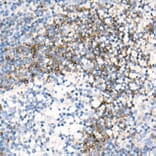 Immunohistochemistry - Anti-CD79b Antibody [ARC52688] (A306997) - Antibodies.com