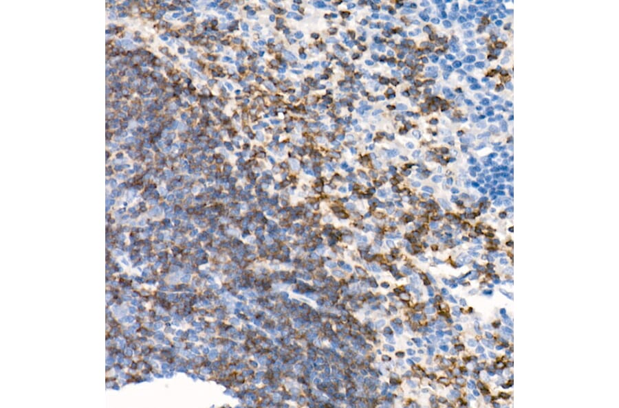 Immunohistochemistry - Anti-CD79b Antibody [ARC52688] (A306997) - Antibodies.com