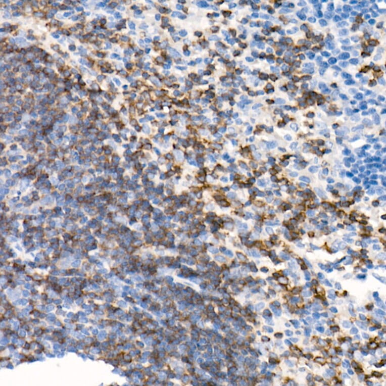 Immunohistochemistry - Anti-CD79b Antibody [ARC52688] (A306997) - Antibodies.com