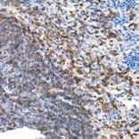 Immunohistochemistry - Anti-CD79b Antibody [ARC52688] (A306997) - Antibodies.com