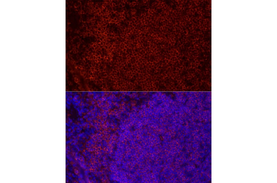 Immunofluorescence - Anti-CD79b Antibody [ARC52688] (A306997) - Antibodies.com