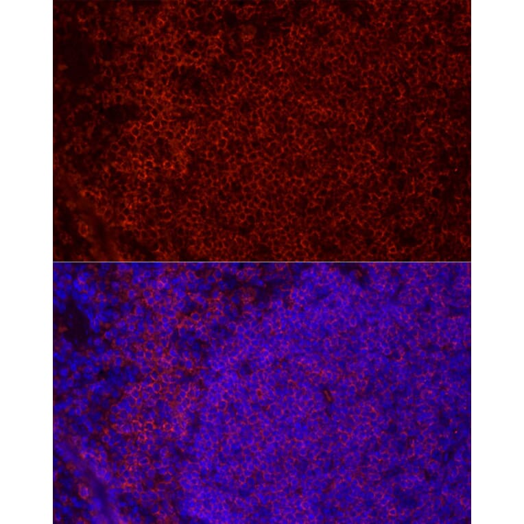 Immunofluorescence - Anti-CD79b Antibody [ARC52688] (A306997) - Antibodies.com