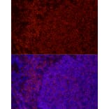 Immunofluorescence - Anti-CD79b Antibody [ARC52688] (A306997) - Antibodies.com