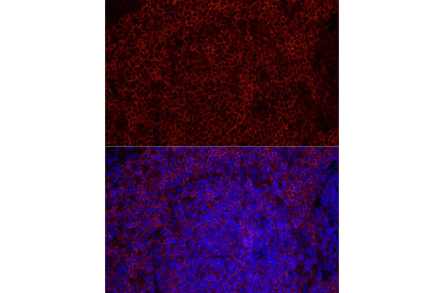 Immunofluorescence - Anti-CD79b Antibody [ARC52688] (A306997) - Antibodies.com