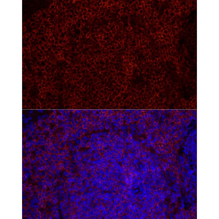 Immunofluorescence - Anti-CD79b Antibody [ARC52688] (A306997) - Antibodies.com