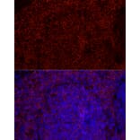 Immunofluorescence - Anti-CD79b Antibody [ARC52688] (A306997) - Antibodies.com