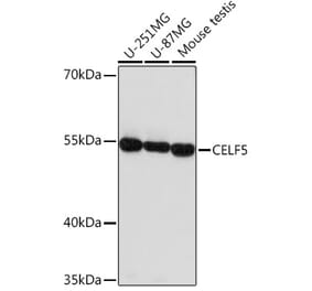 Western Blot - Anti-CELF5 Antibody (A306998) - Antibodies.com