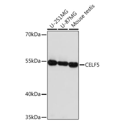 Western Blot - Anti-CELF5 Antibody (A306998) - Antibodies.com