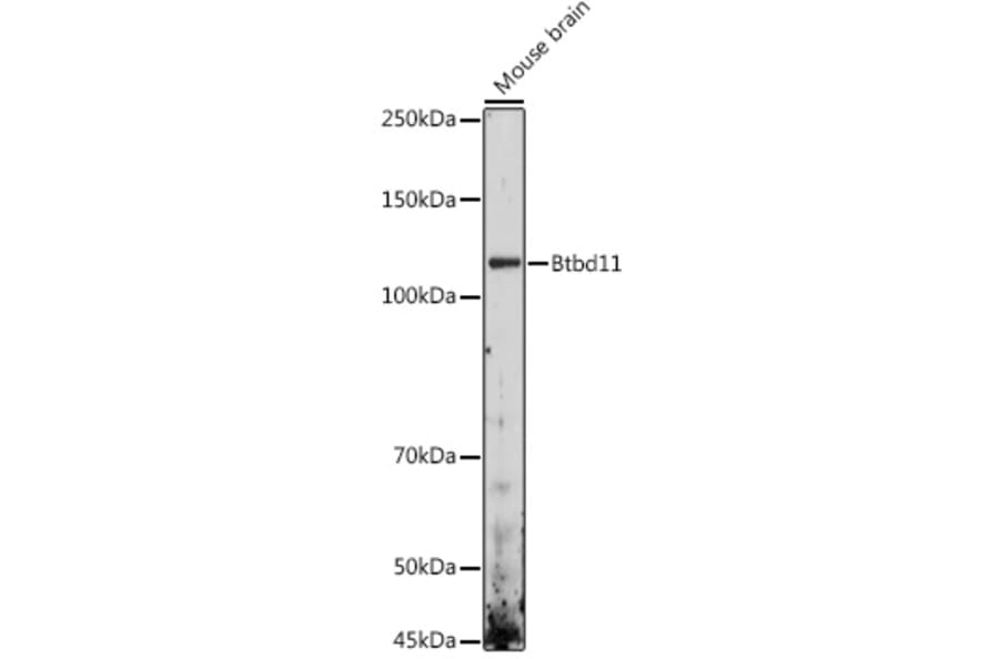 Western Blot - Anti-Abtb3 Antibody (A306999) - Antibodies.com