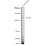 Western Blot - Anti-Abtb3 Antibody (A306999) - Antibodies.com