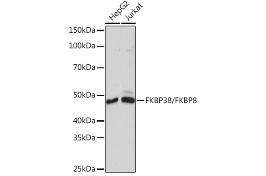 Western Blot - Anti-FKBP38 Antibody [ARC1259] (A307004) - Antibodies.com