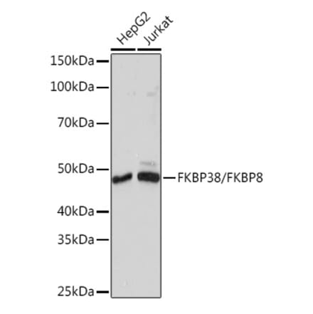 Western Blot - Anti-FKBP38 Antibody [ARC1259] (A307004) - Antibodies.com