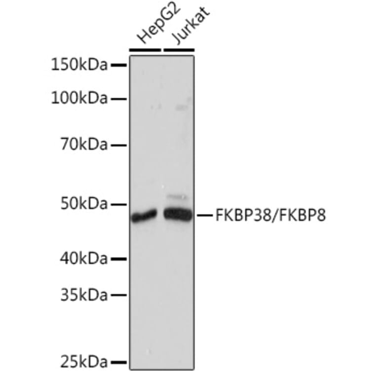 Western Blot - Anti-FKBP38 Antibody [ARC1259] (A307004) - Antibodies.com