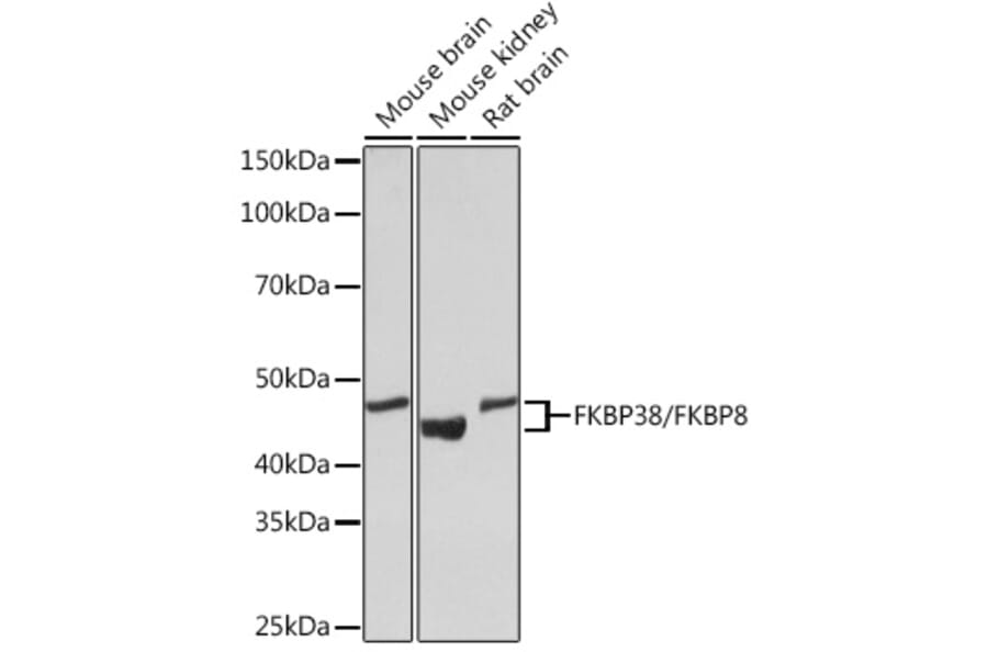 Western Blot - Anti-FKBP38 Antibody [ARC1259] (A307004) - Antibodies.com