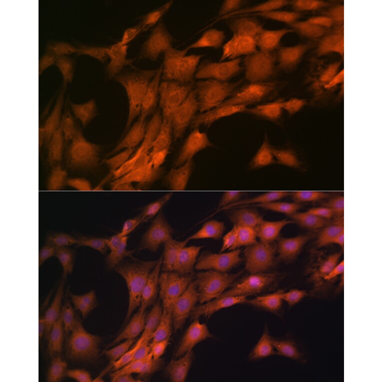 Immunofluorescence - Anti-FKBP38 Antibody [ARC1259] (A307004) - Antibodies.com