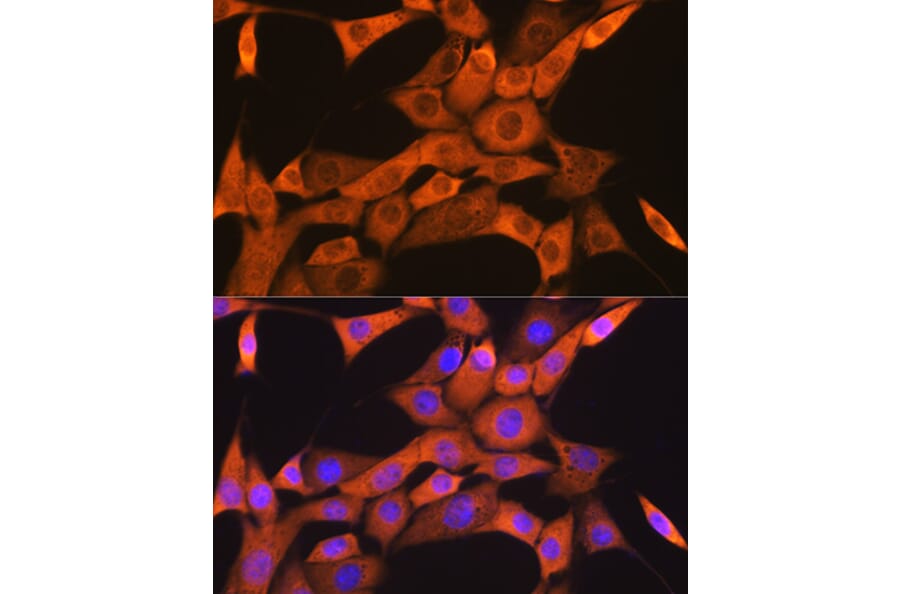 Immunofluorescence - Anti-FKBP38 Antibody [ARC1259] (A307004) - Antibodies.com