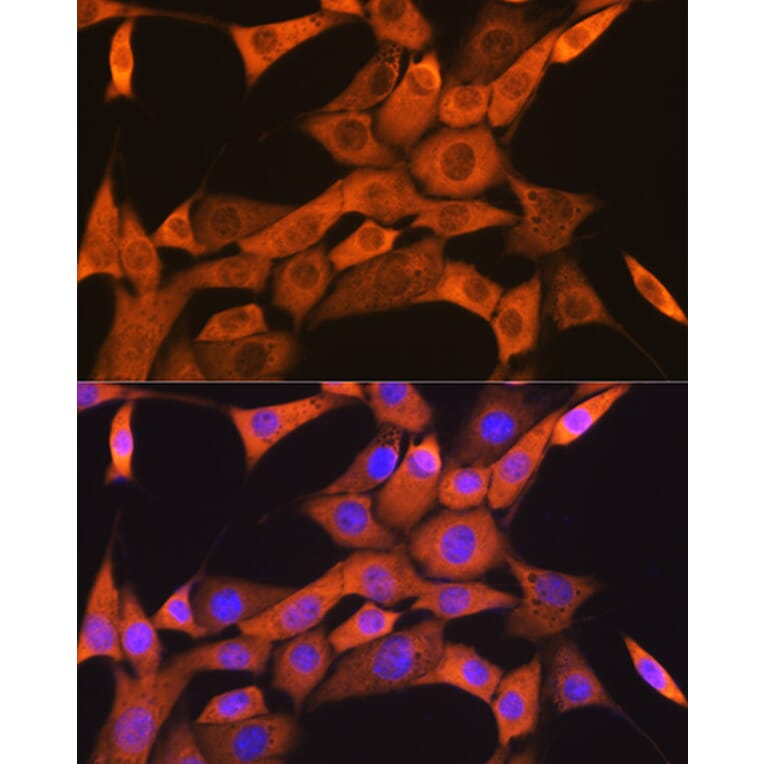 Immunofluorescence - Anti-FKBP38 Antibody [ARC1259] (A307004) - Antibodies.com