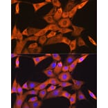 Immunofluorescence - Anti-FKBP38 Antibody [ARC1259] (A307004) - Antibodies.com