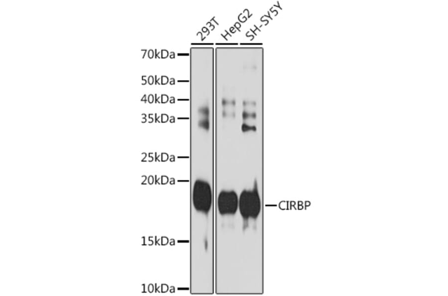Western Blot - Anti-CIRP Antibody [ARC2472] (A307005) - Antibodies.com