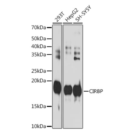 Western Blot - Anti-CIRP Antibody [ARC2472] (A307005) - Antibodies.com