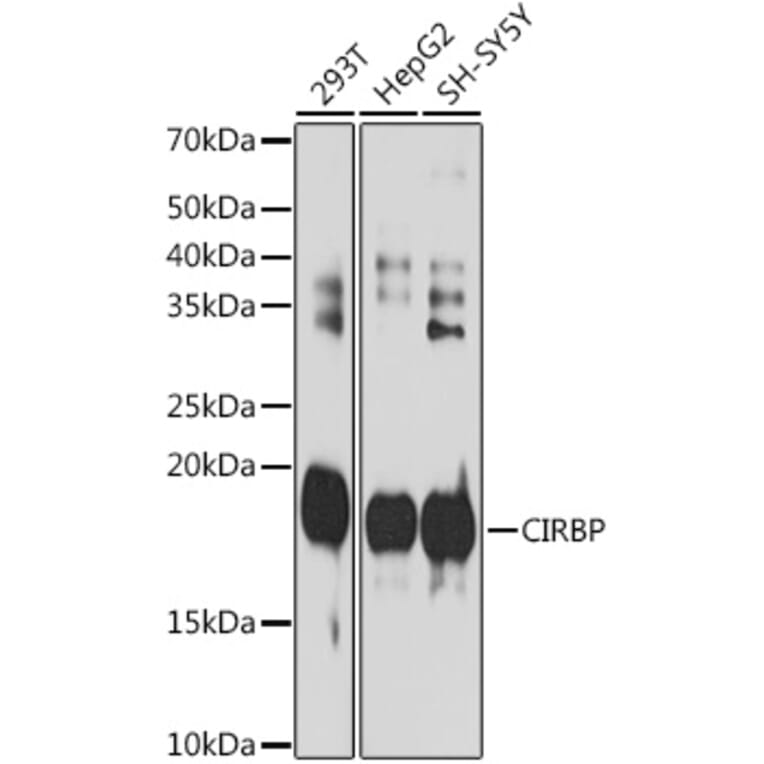 Western Blot - Anti-CIRP Antibody [ARC2472] (A307005) - Antibodies.com