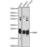 Western Blot - Anti-CIRP Antibody [ARC2472] (A307005) - Antibodies.com