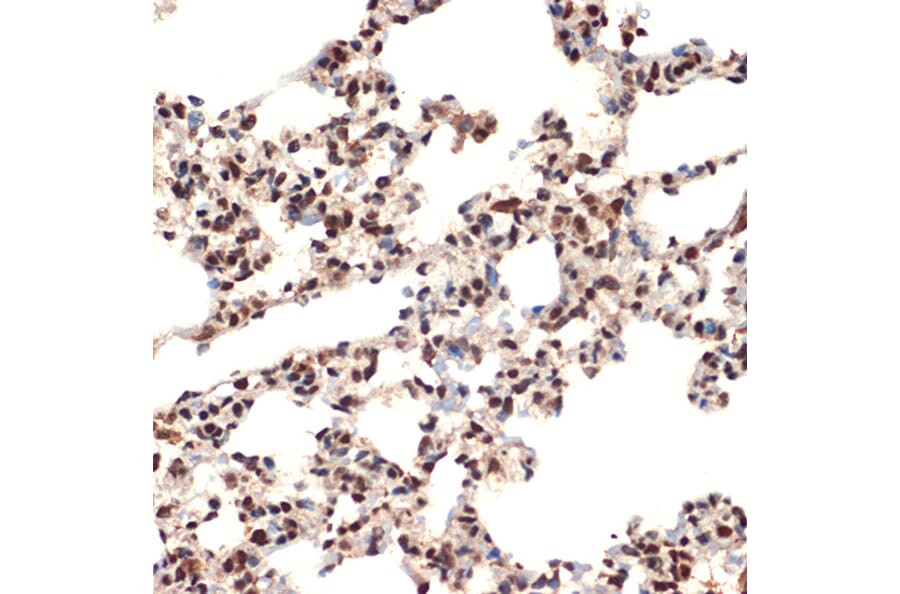 Immunohistochemistry - Anti-CIRP Antibody [ARC2472] (A307005) - Antibodies.com
