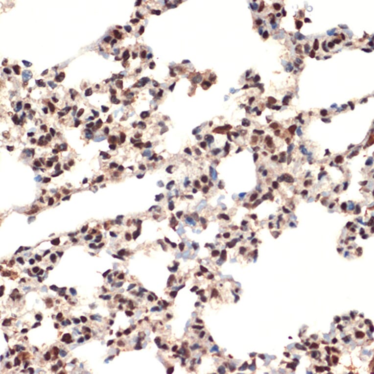 Immunohistochemistry - Anti-CIRP Antibody [ARC2472] (A307005) - Antibodies.com