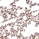 Immunohistochemistry - Anti-CIRP Antibody [ARC2472] (A307005) - Antibodies.com