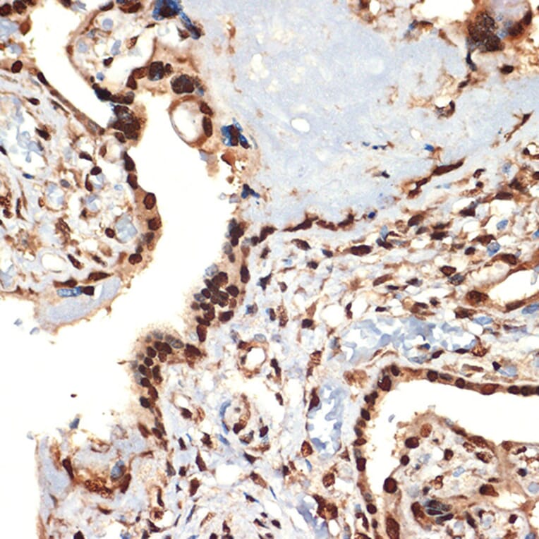 Immunohistochemistry - Anti-CIRP Antibody [ARC2472] (A307005) - Antibodies.com