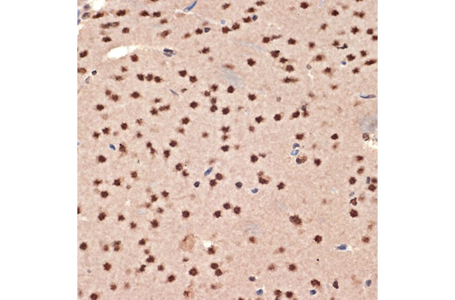 Immunohistochemistry - Anti-CIRP Antibody [ARC2472] (A307005) - Antibodies.com