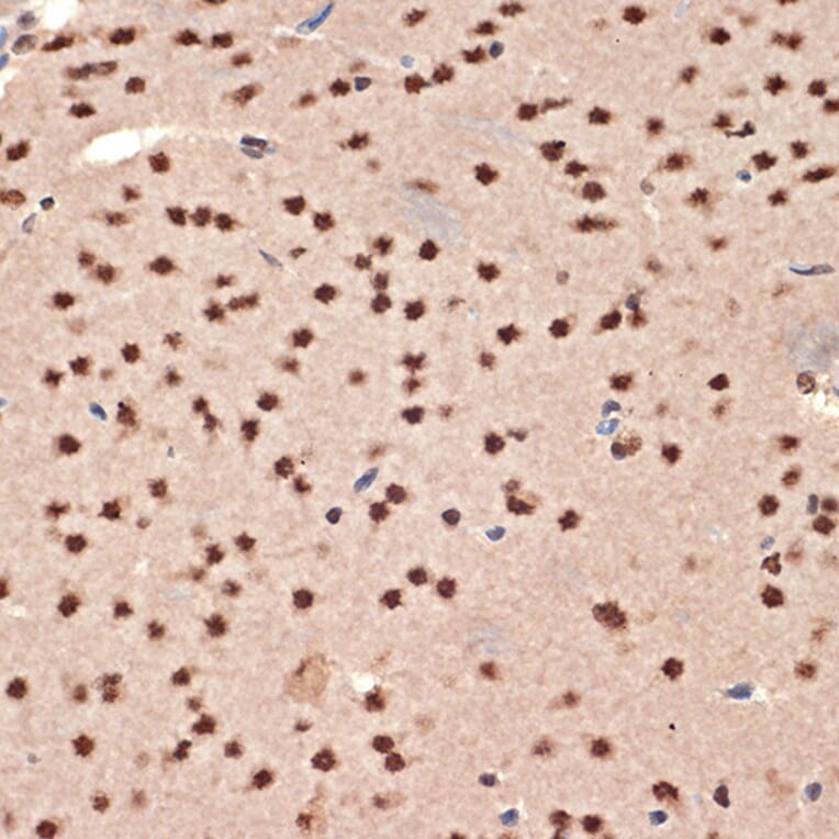 Immunohistochemistry - Anti-CIRP Antibody [ARC2472] (A307005) - Antibodies.com