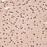 Immunohistochemistry - Anti-CIRP Antibody [ARC2472] (A307005) - Antibodies.com