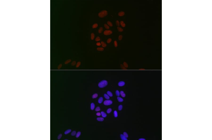 Immunofluorescence - Anti-CIRP Antibody [ARC2472] (A307005) - Antibodies.com